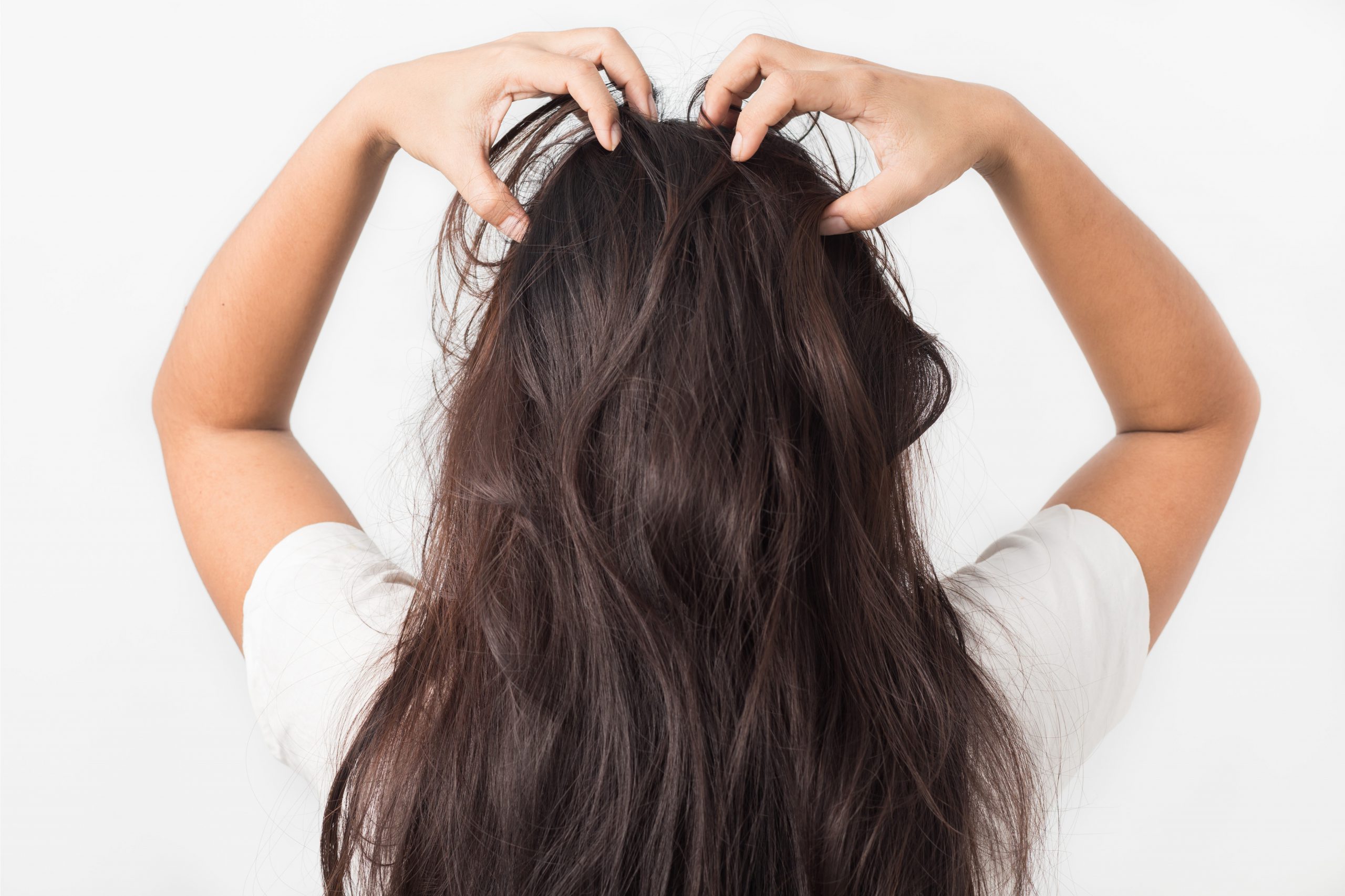 Eyebrow Dandruff: It’s a Thing - Taffeta